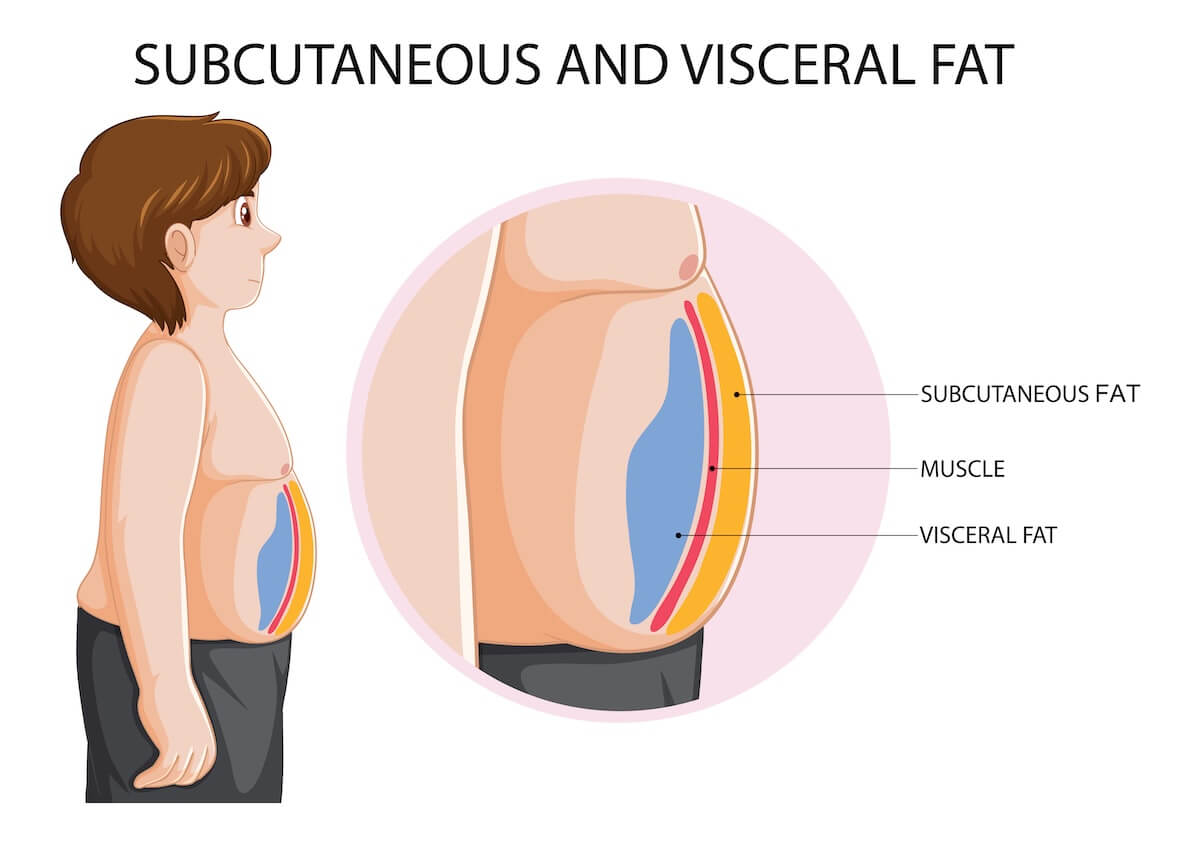 Visceral Fat: The Hidden Threat to Longevity and Health